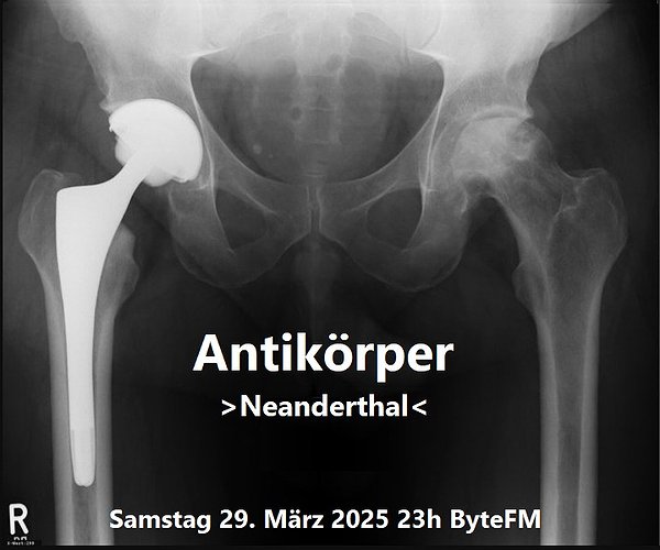 Antikörper - Neanderthal
